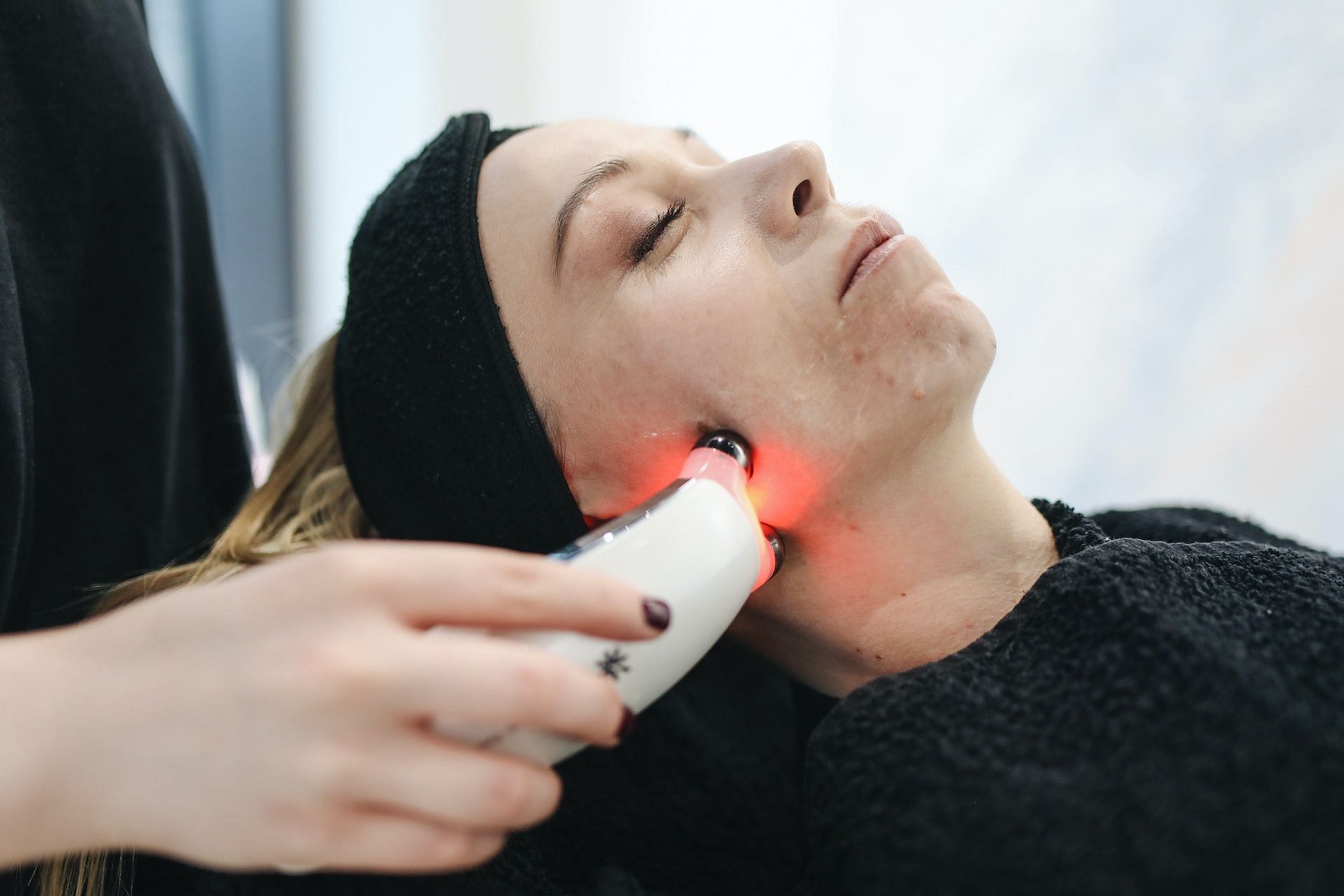 Laser treatment can help with red moles on skin. (Photo via Pexels/Polina Tankilevitch)