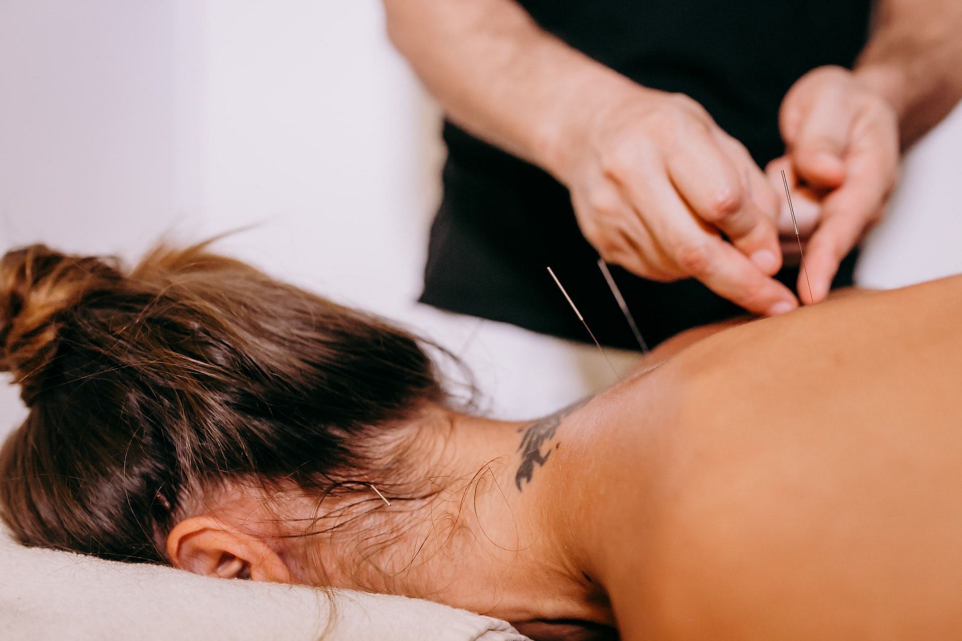 Acupuncture for weight loss works in several ways. (Photo via Pexels/Alma Thai)