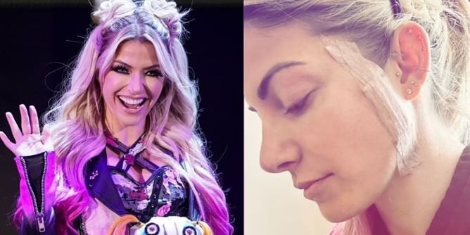 [Photo] Alexa Bliss shares recovery pictures after recent skin cancer scare