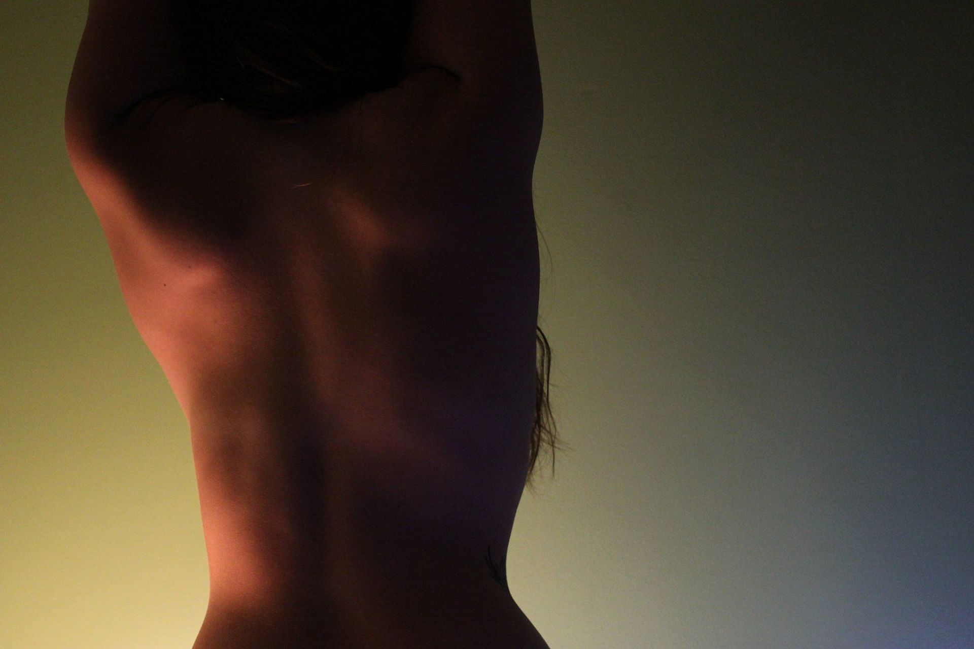 Scoliosis is the name given to a condition in which the spine curves sideways (Image via Flickr)