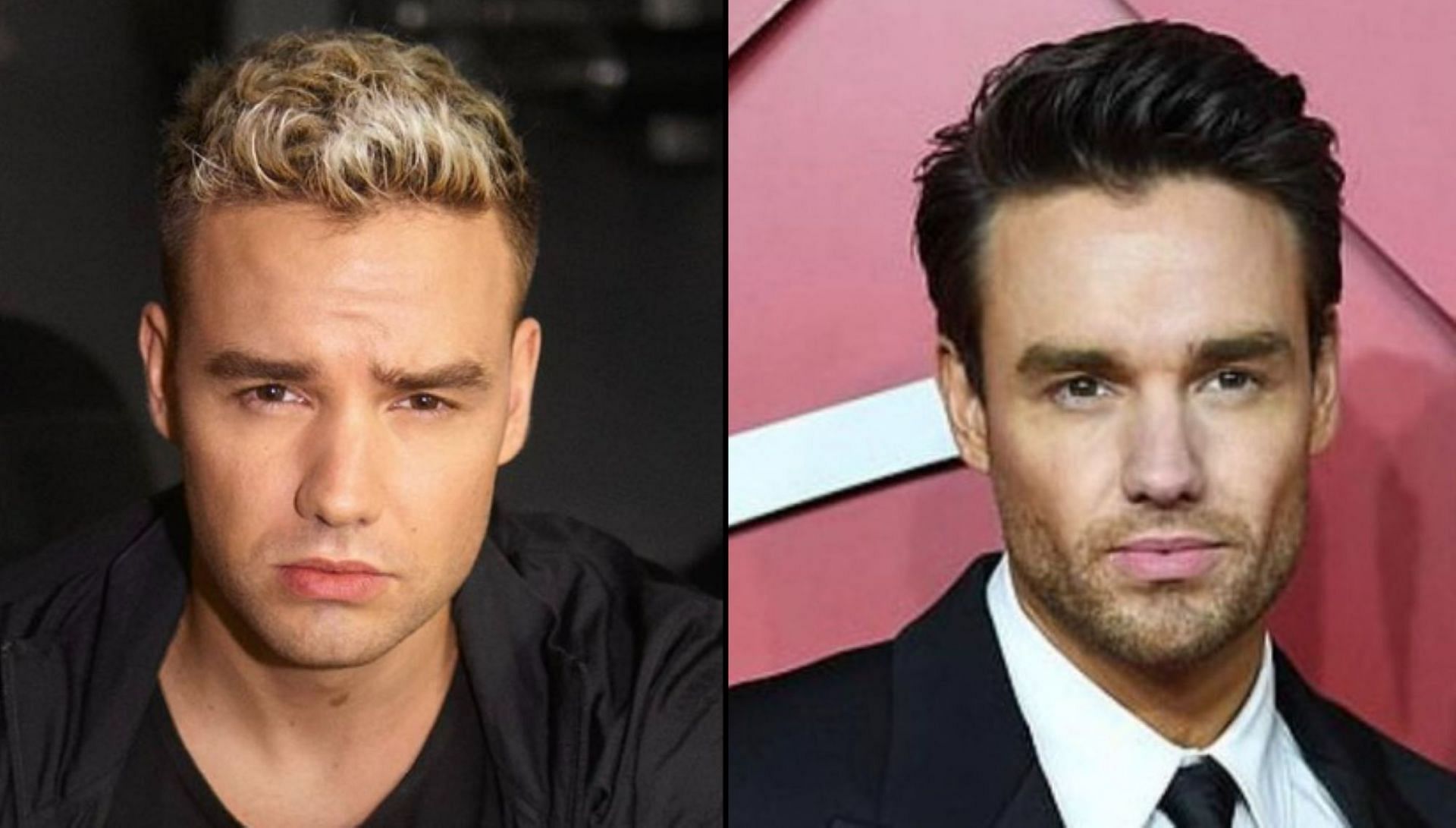 Liam Payne Buccal Fat Removal Claim Surfaces As Before And After Pictures Go Viral 1606