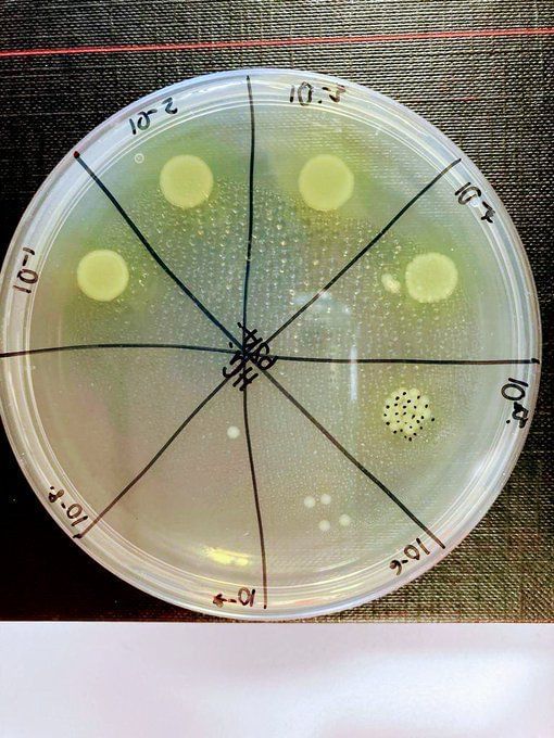 Pseudomonas Aeruginosa, infection, infection death: What is Pseudomonas ...