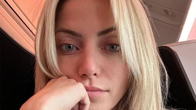 [PHOTO] Alexa Bliss shows off stitches on her face after skin procedure