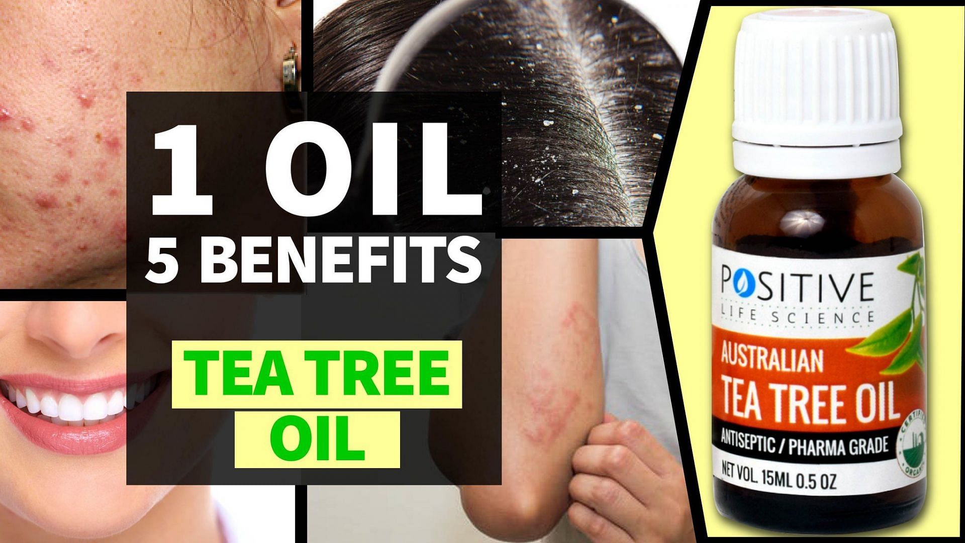 Tea tree oil is often used a treatment of athlete&#039;s foot. (Image via Flickr)