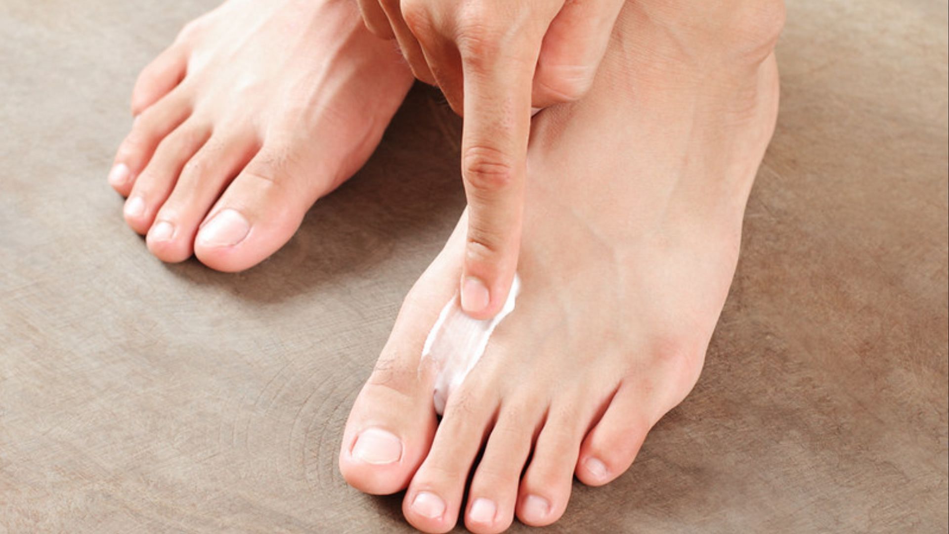 Keeping your feet clean and moisturized is the best way to prevent athlete&#039;s foot. (Image via Flickr)