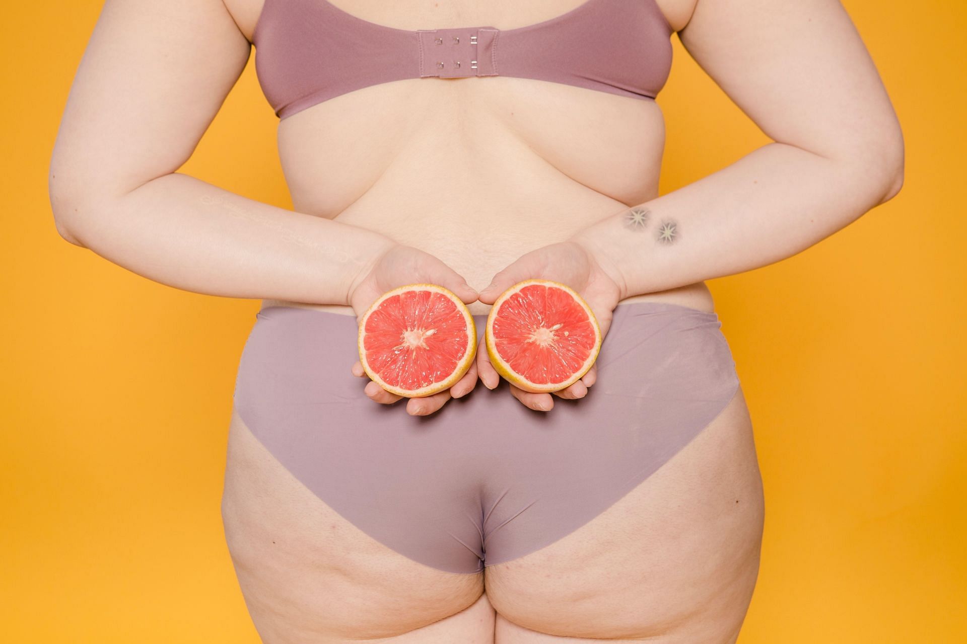 Cellulite is common among women (Image via Pexels)