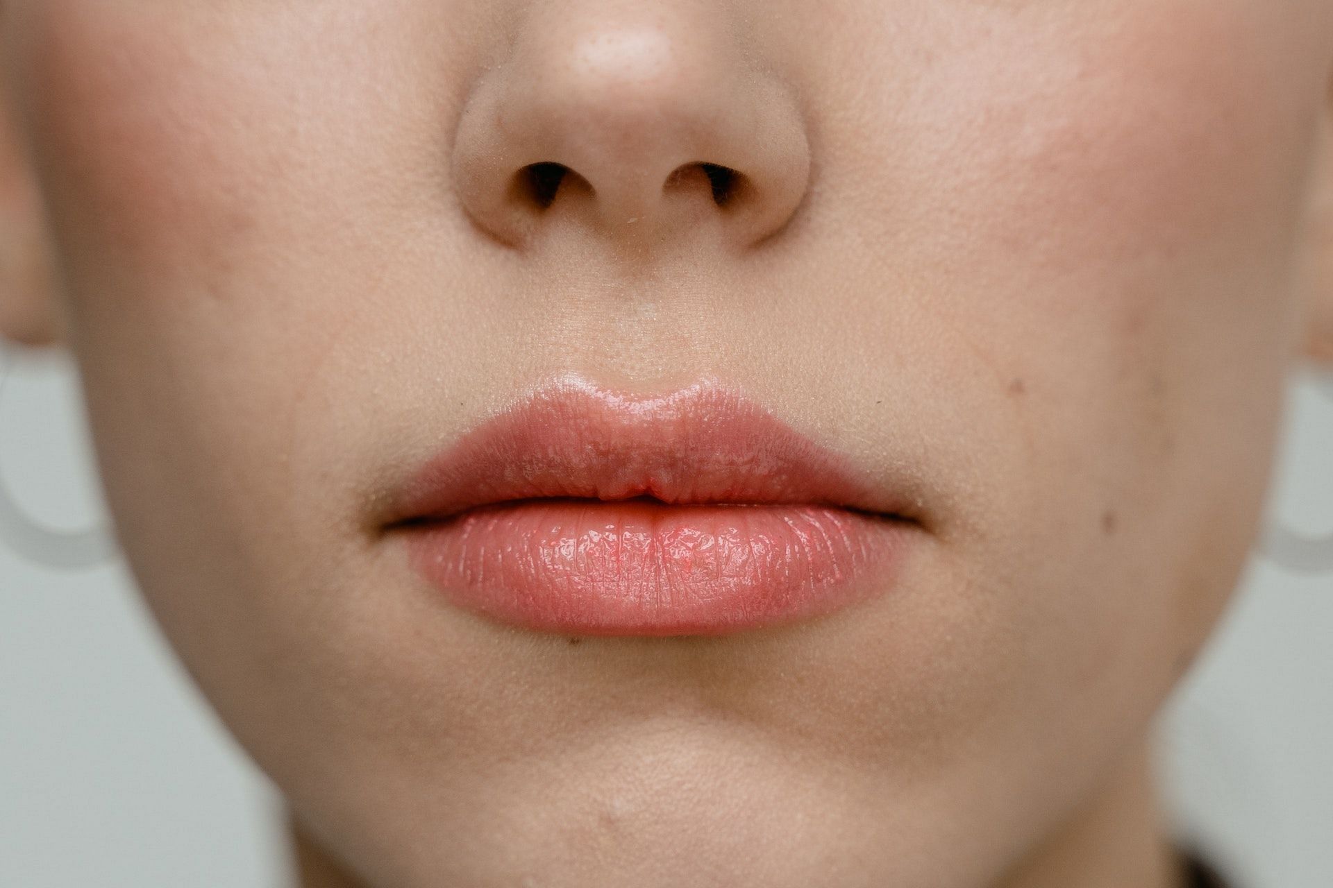 Chapped lips can be caused due to dehydration and dryness. (Photo via Pexels/MART  PRODUCTION)