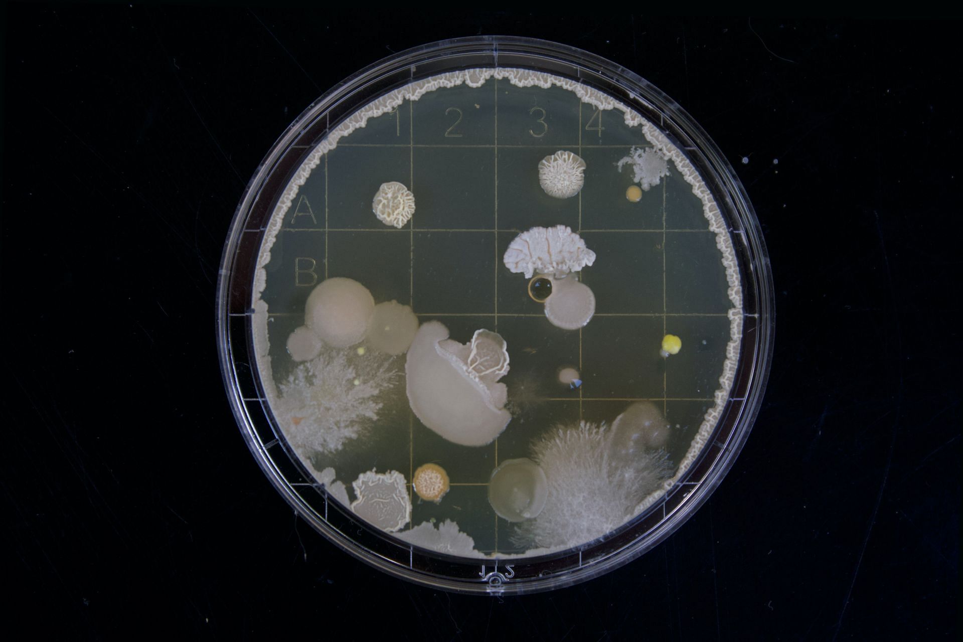 Microbes or microbial toxins cause foodborne infections (Image via Unsplash/Michael Schiffer)