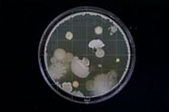Food Poisoning Can Leftover Rice Make You Sick 