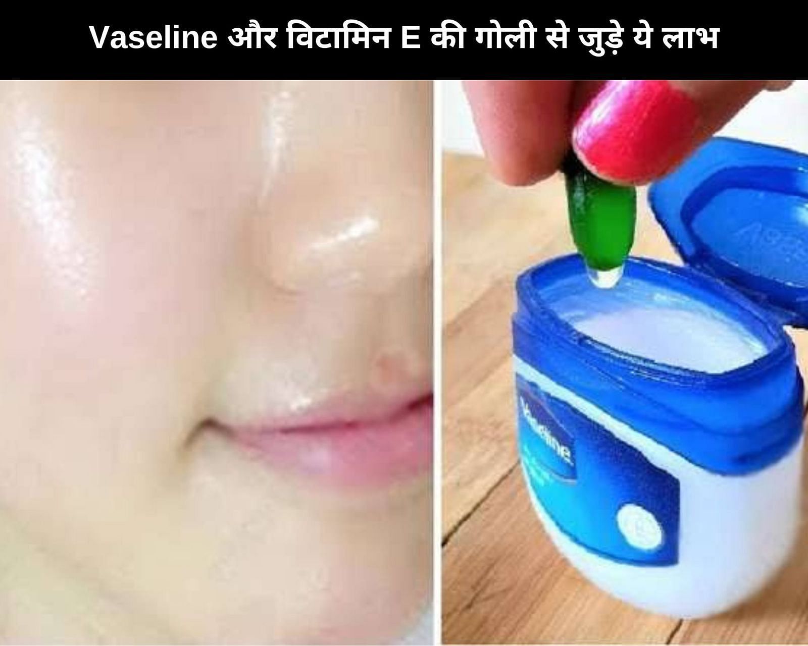 Vaseline और विटामिन E की गोली से जुड़े ये 5 लाभ (फोटो - sportskeedaहिन्दी)