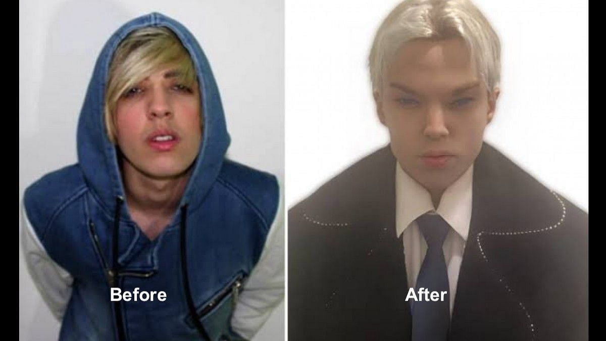 Before and after images of the actor, as he looked completely different after 12 surgeries. (Image via Twitter/@BuzzNetizens)