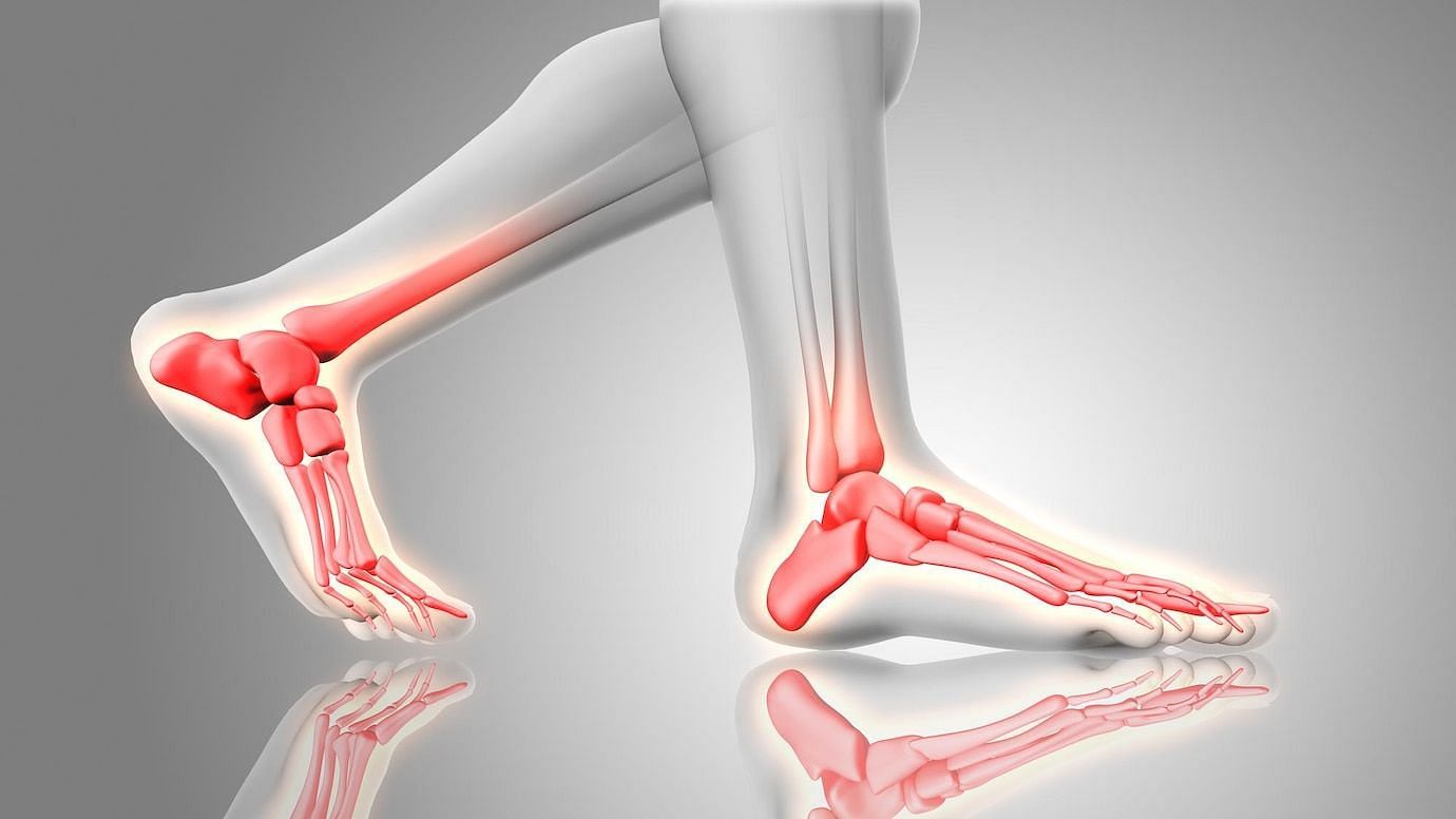 It&#039;s caused by the inflammation of the plantar fascia. (Image via Freepik/Kjpargeter)
