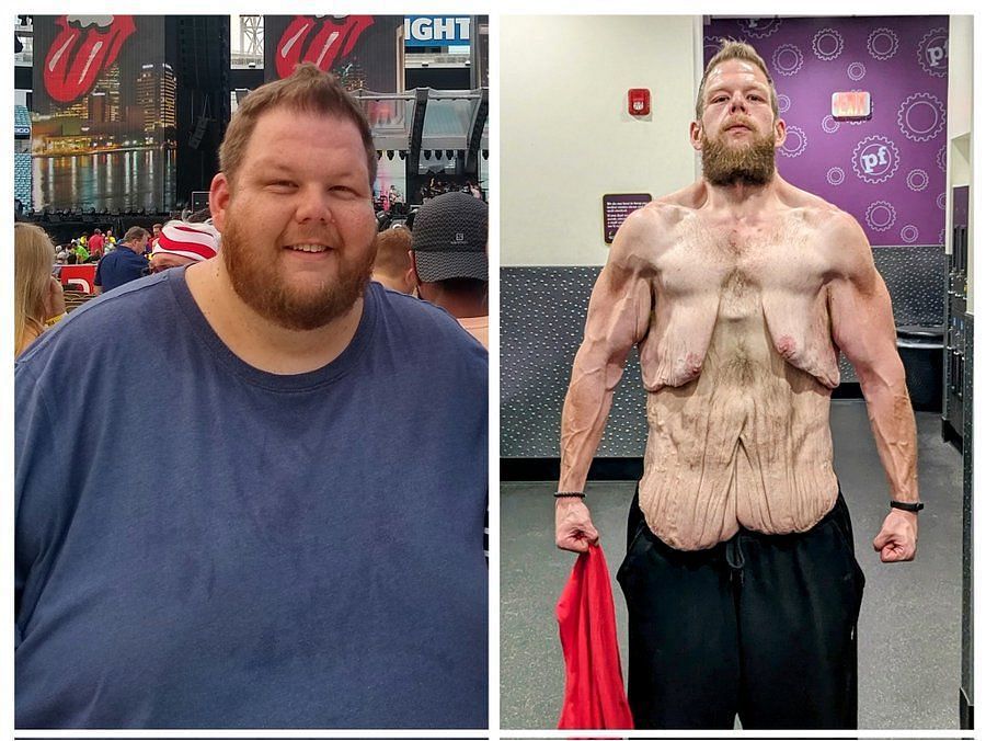 Cole Prachaska weight loss journey. (Image via Twitter)
