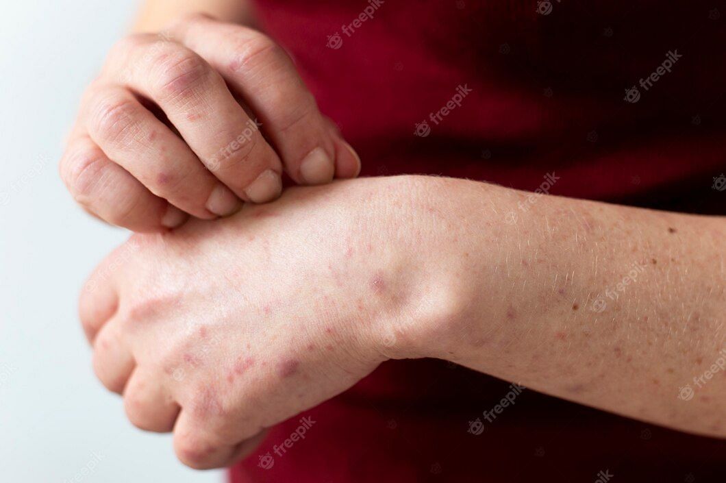 Ganglion cysts are lumps that form on joints or tendons. (Image via Freepik)