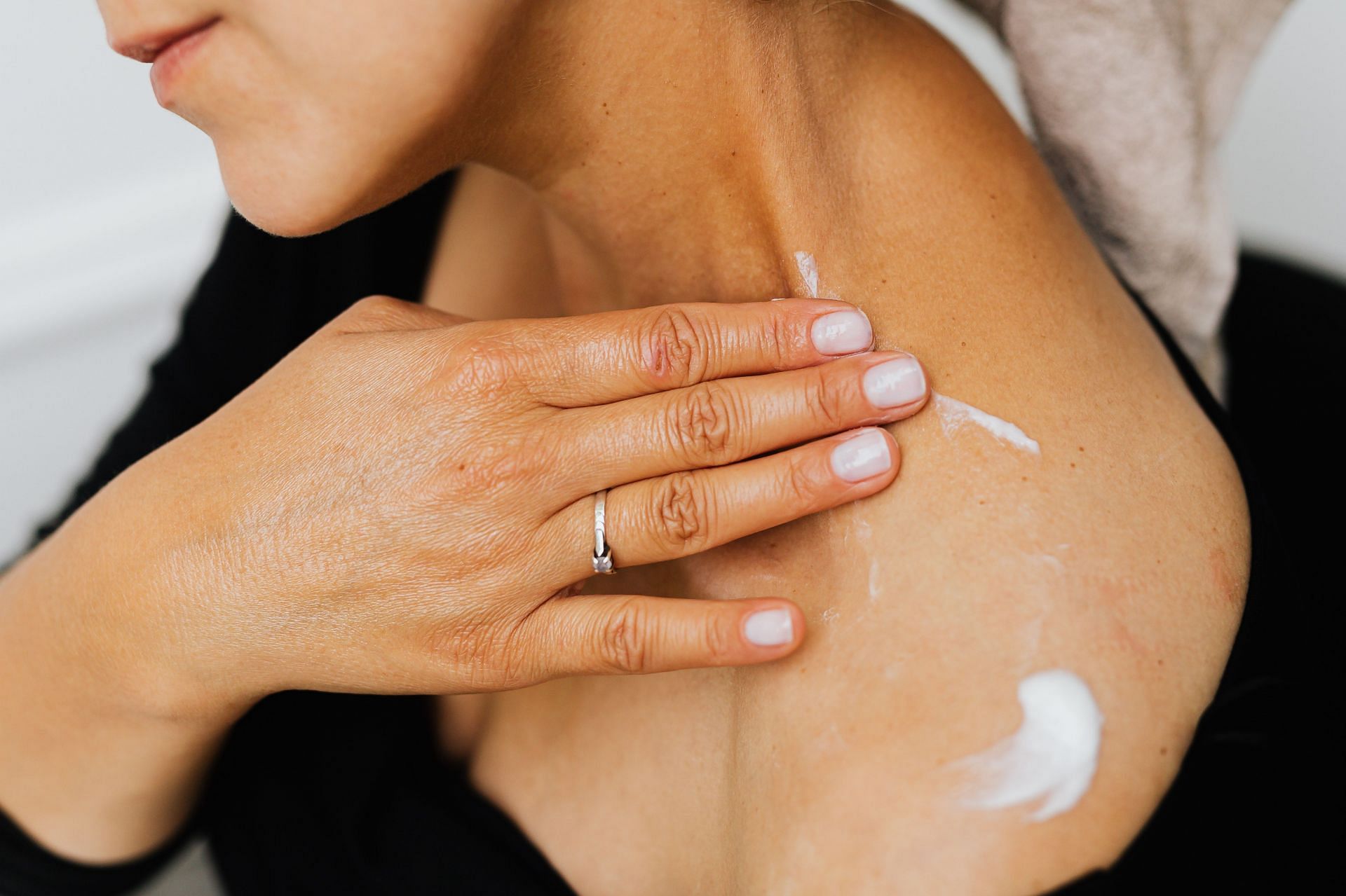 Tight clothing can also cause skin to chafe. (Image via Pexels/ Karolina Grabowska)