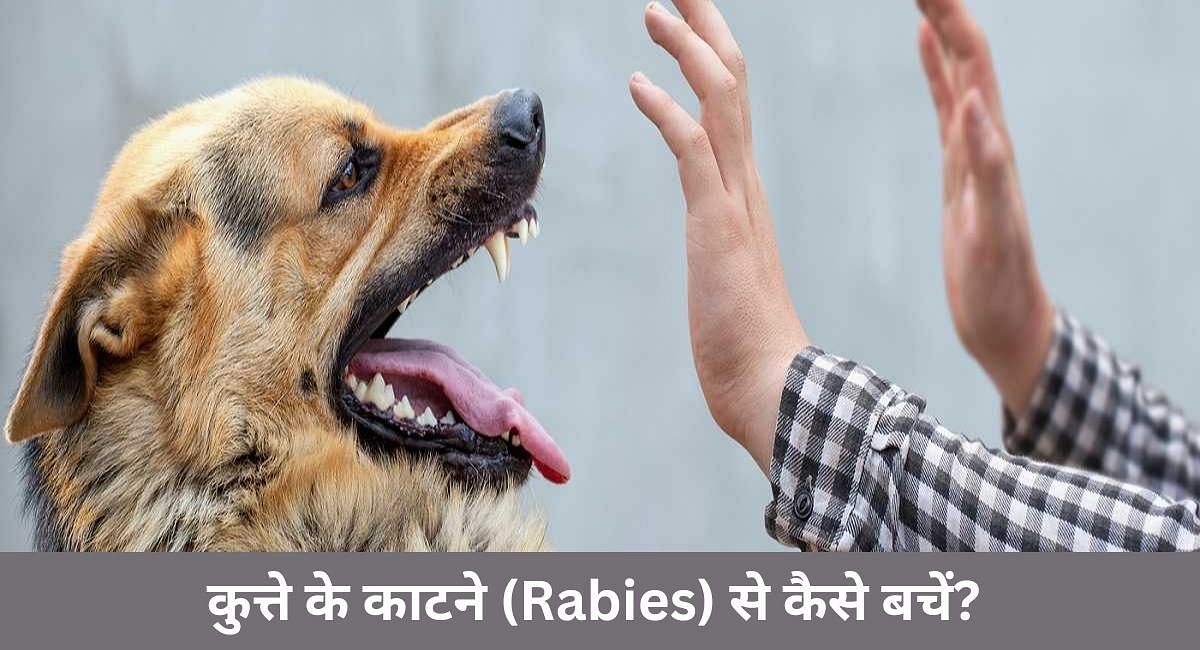 कुत्ते के काटने (Rabies) से कैसे बचें?  (फोटो - sportskeedaहिन्दी)