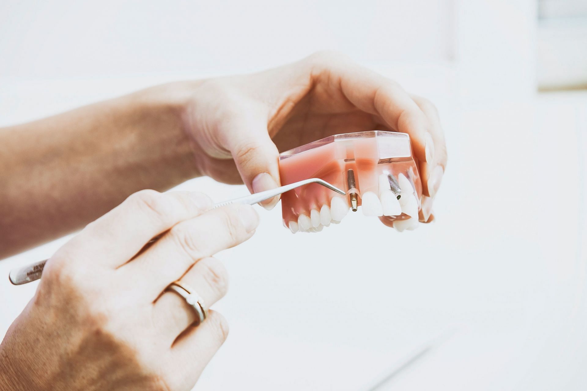 Imperfect dentures may also cause bleeding gums. (Image via Unsplash/ Peter Kasprzyk)