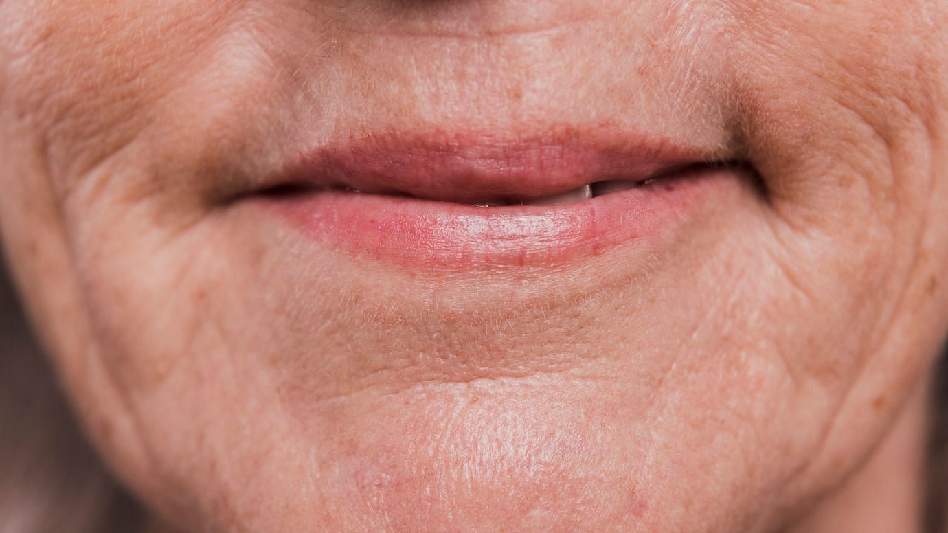 Lip lines are caused by a loss of collagen and elastin in the skin. (Image via Freepik)