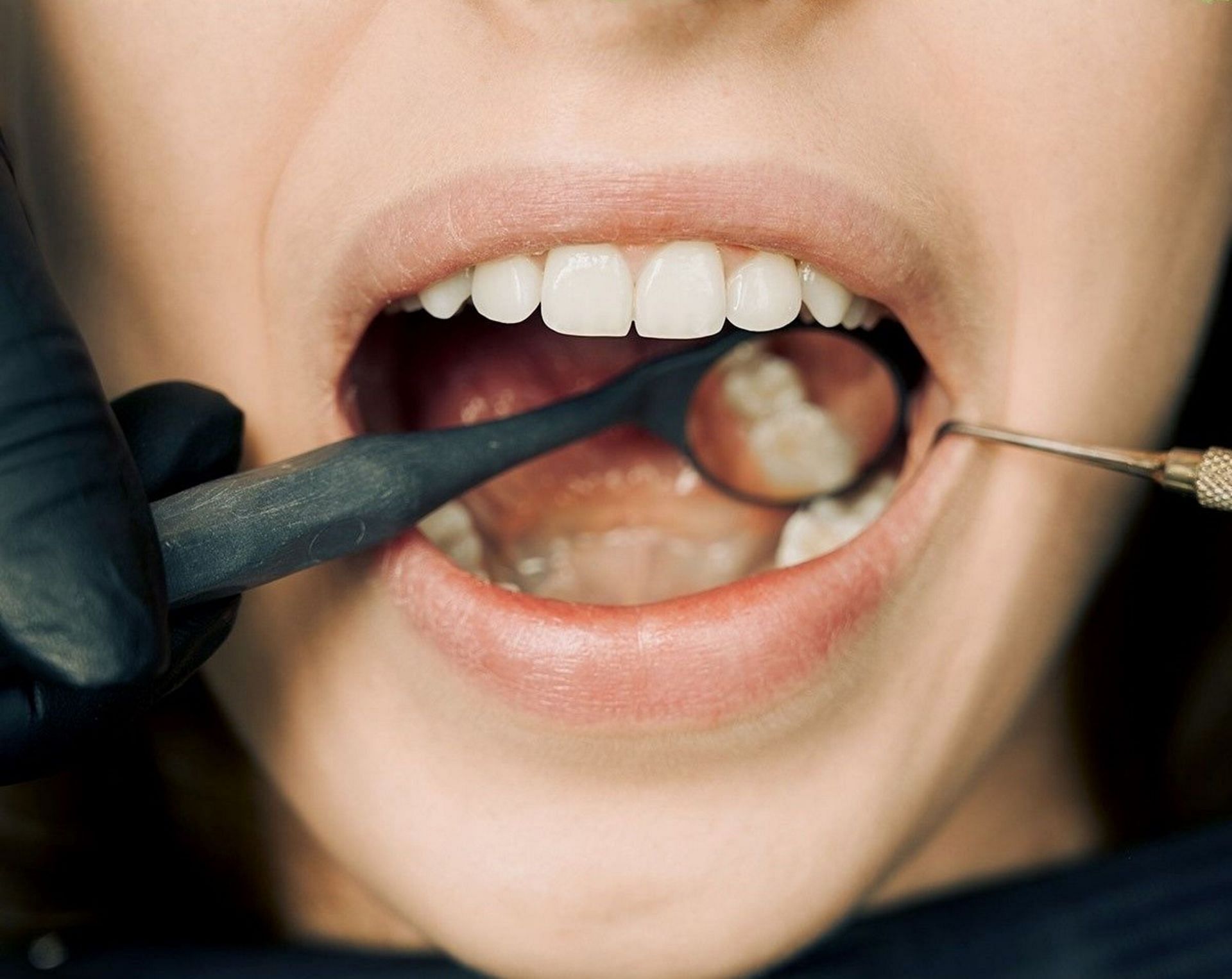 Doctor examining teeth (Image via Pexels)