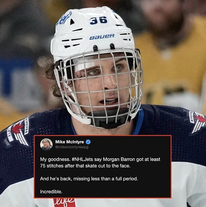 Winnipeg Jets' Morgan Barron gets 75 stitches after getting cut by