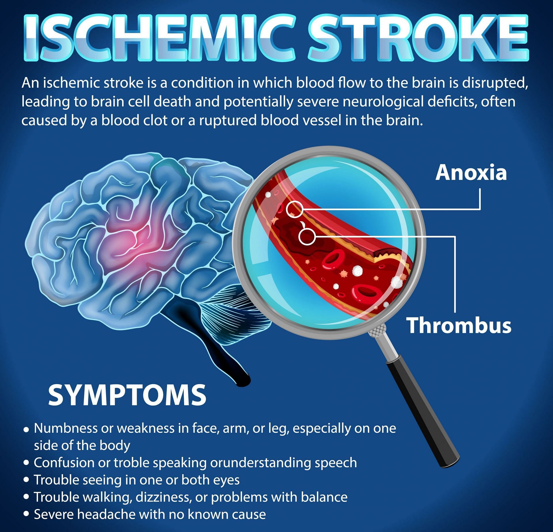 Can stroke cause dementia? (Image via Freepik/Freepik)