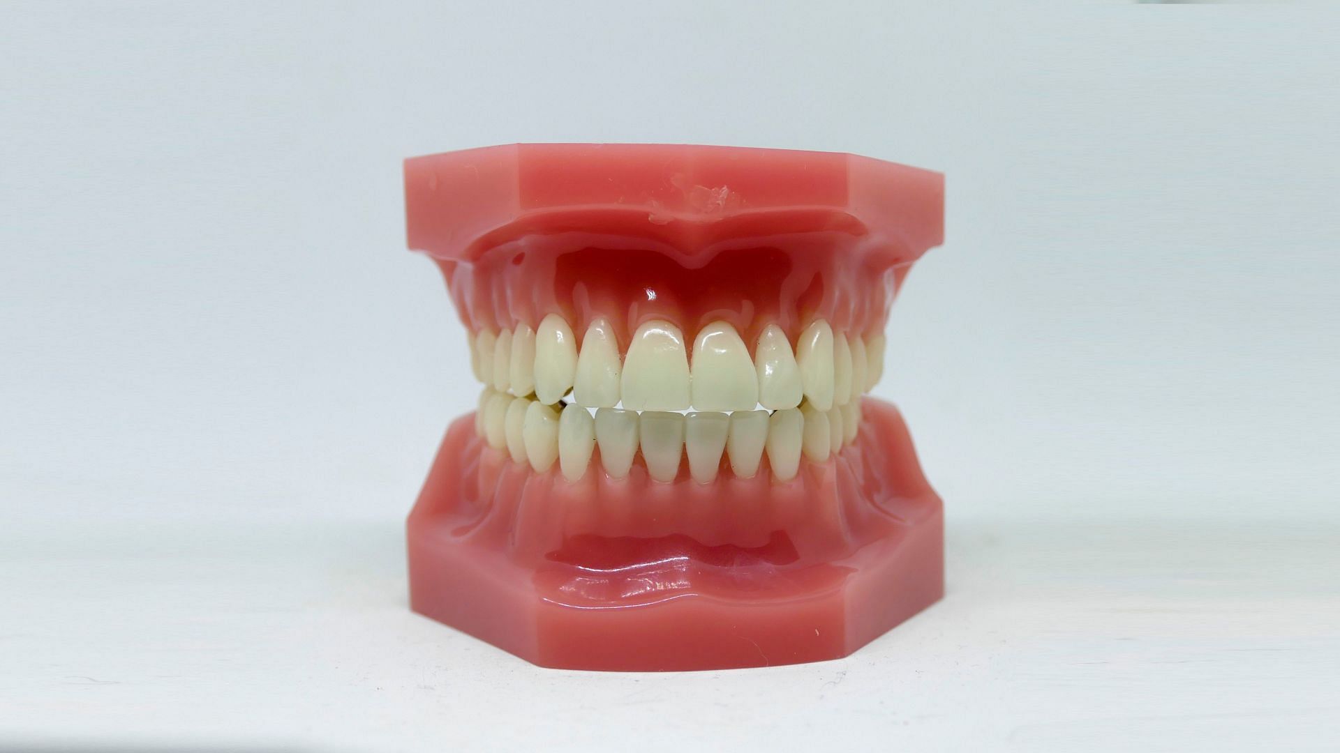 Teeth whitening brightens your smile. (Image Via Pexels)