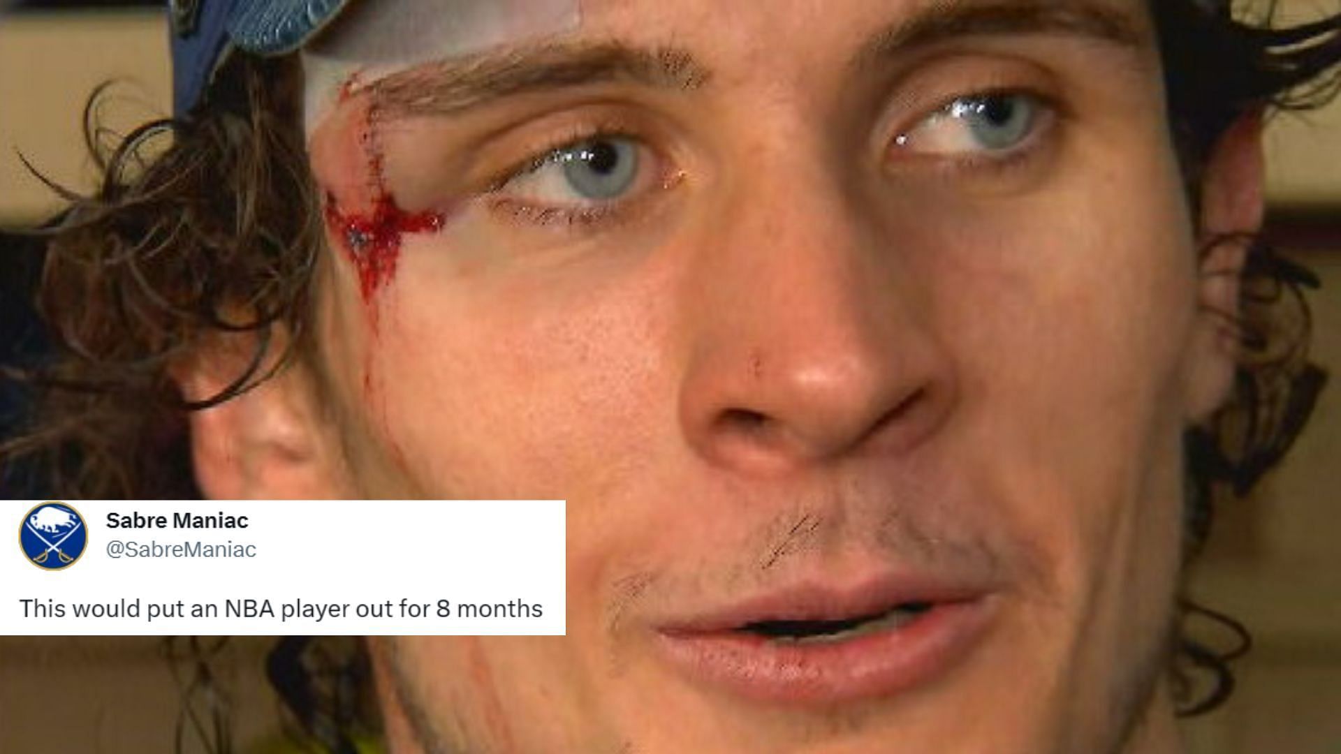 NHL fans in disbelief after Morgan Barron comes back to play after receiving 75 stitches