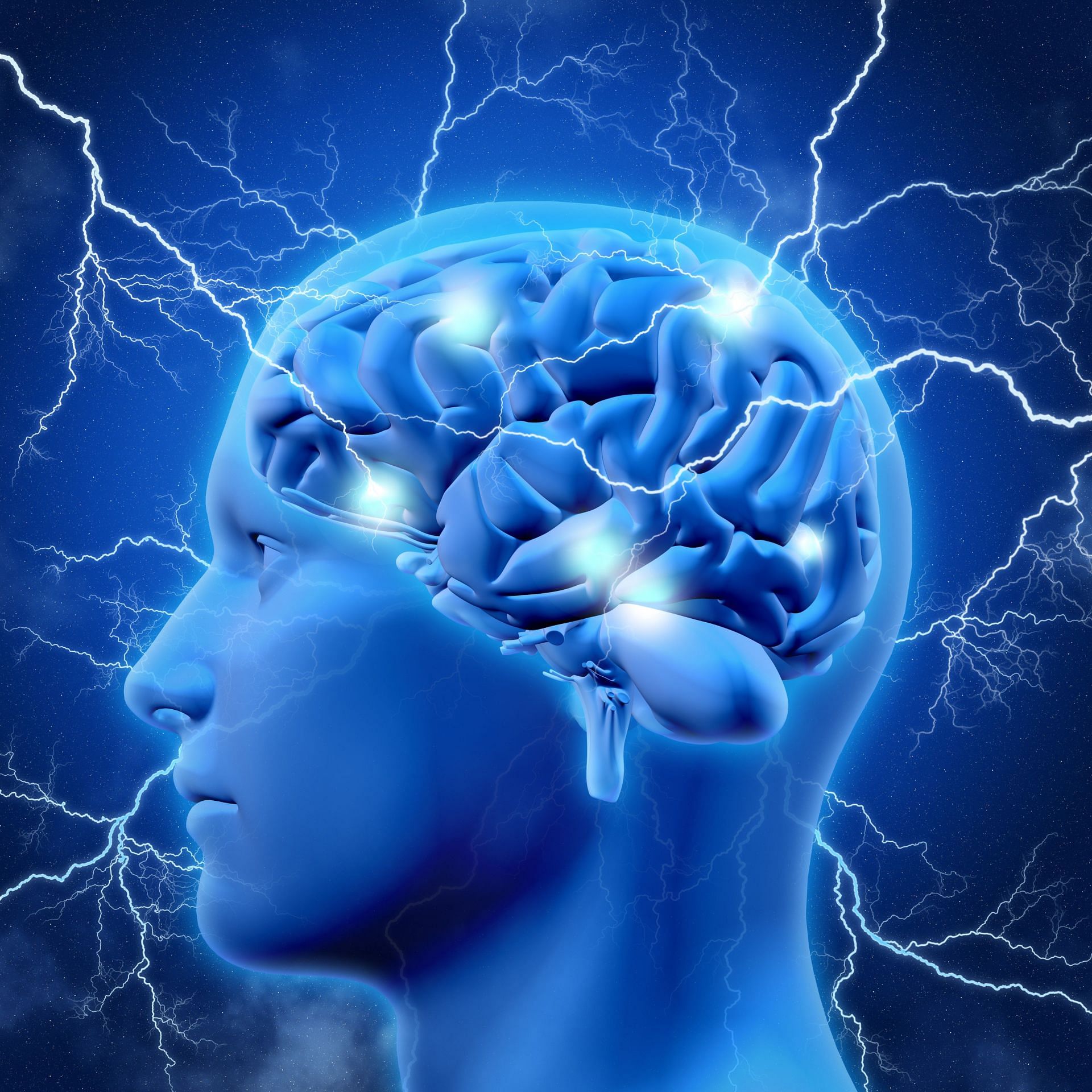 Are stress induced seizures real? When can you experience them? (Image via Freepik/ Freepik)