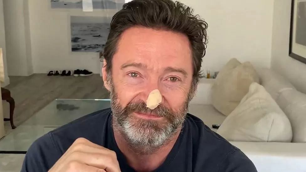 Actor Hugh Jackman has taken to social media to urge his followers to prioritize sun protection (@THEHUGHJACKMAN / INSTAGRAM)