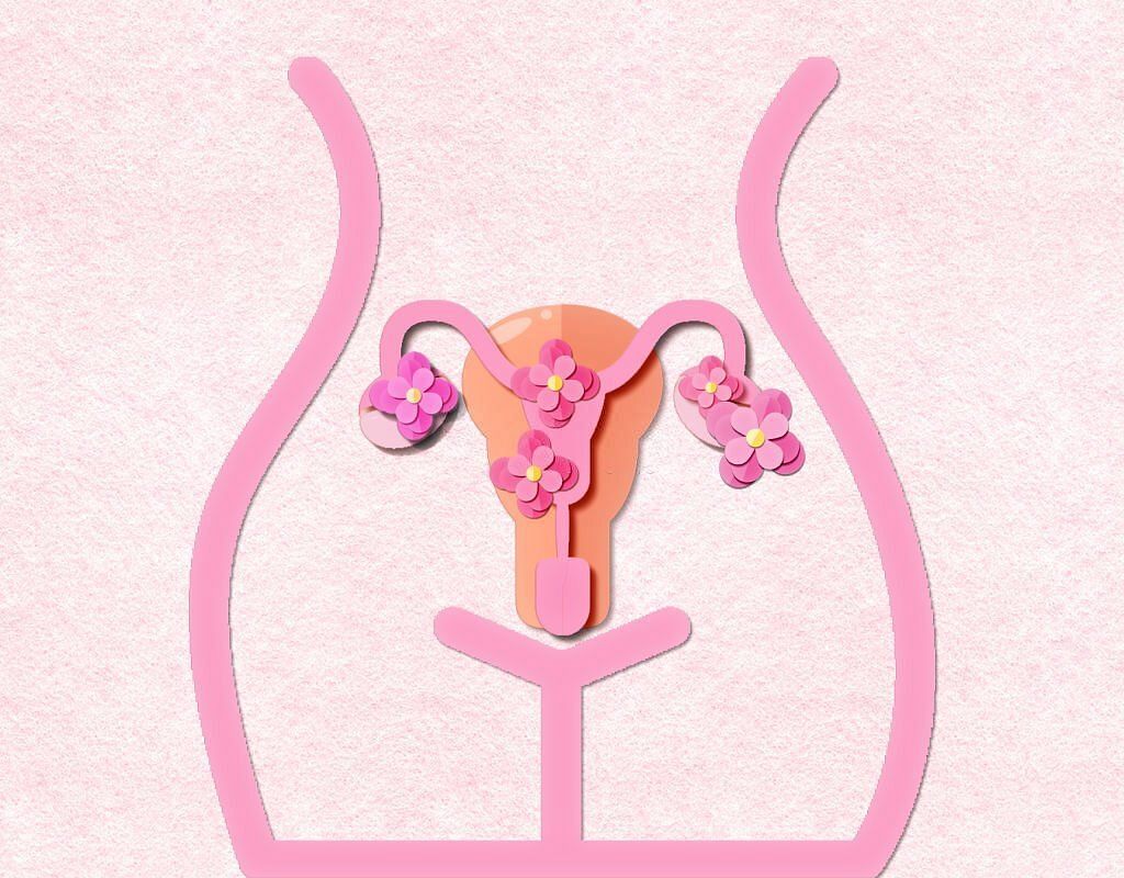 PCOS and its effect on fertility (Image via Getty)