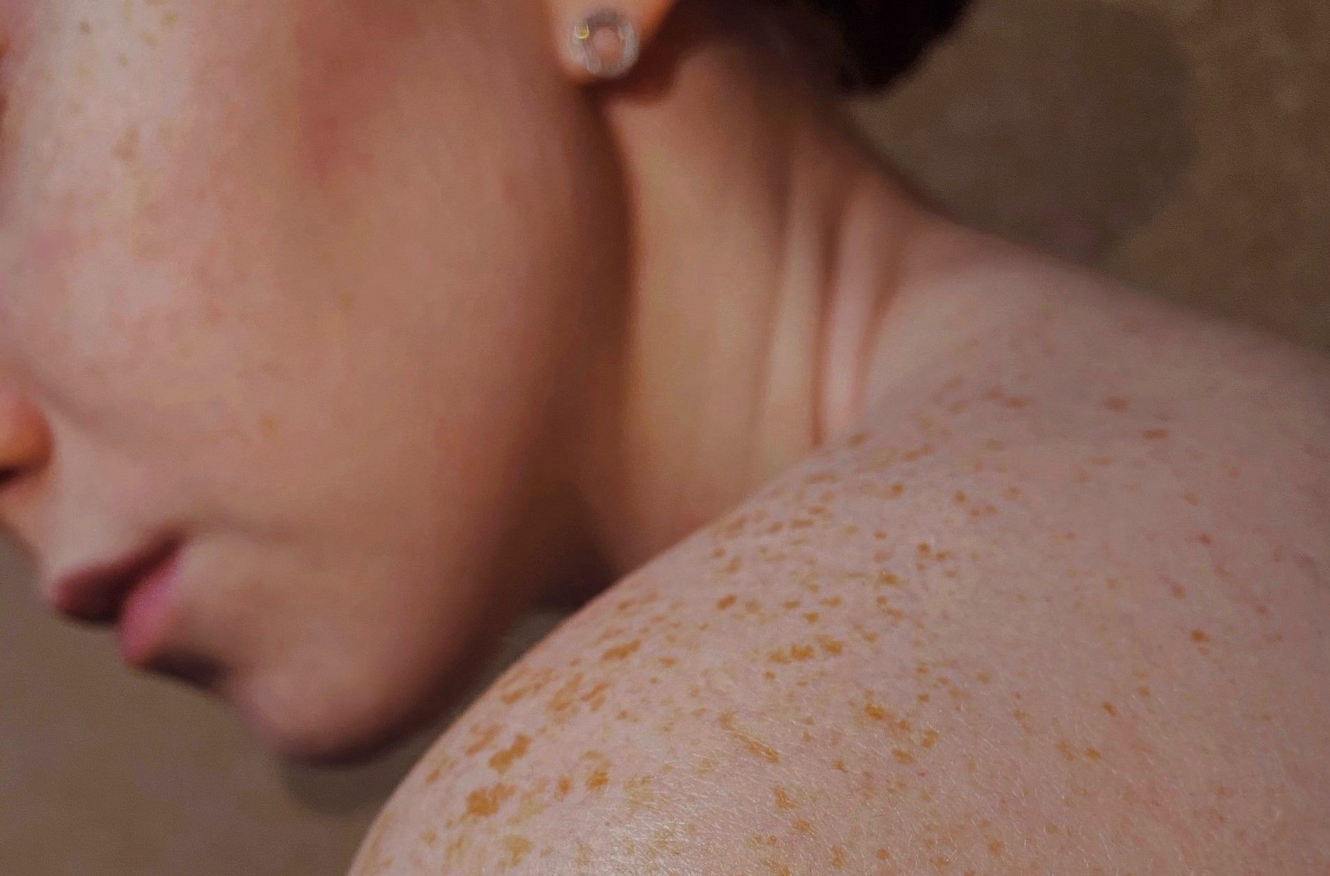 Skin peeling (Photo via Valeria Smirnova/Unsplash)