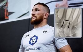 Merab Dvalishvili provides surgery update and thanks top UFC featherweight for his support