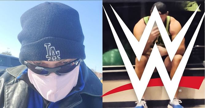 WWE might have lost faith in a former champion after he denied major offer due to hair transplant surgery
