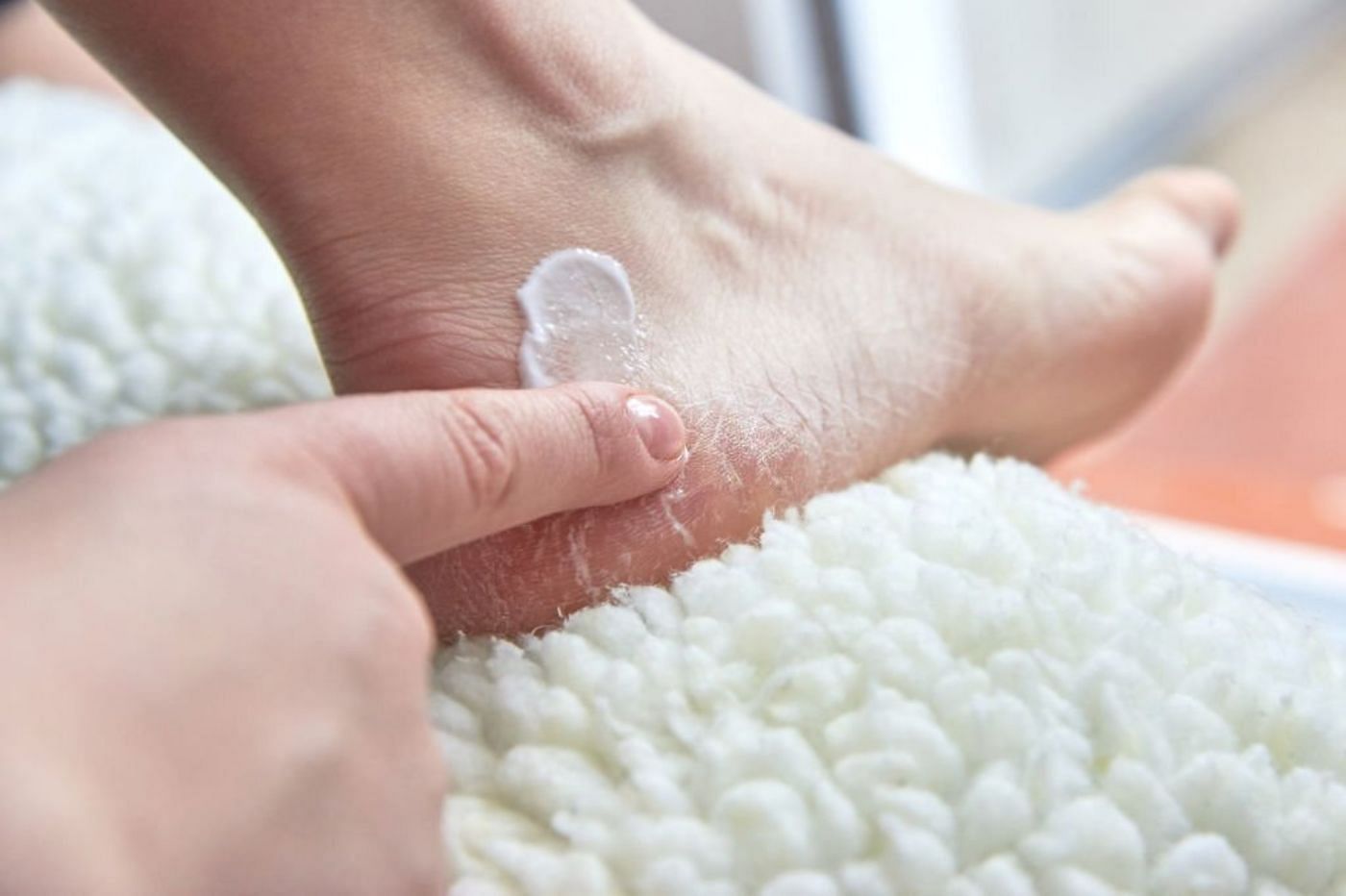 Tips to soothe and treat dry, cracked hands and feet (Image via iStockPhoto)