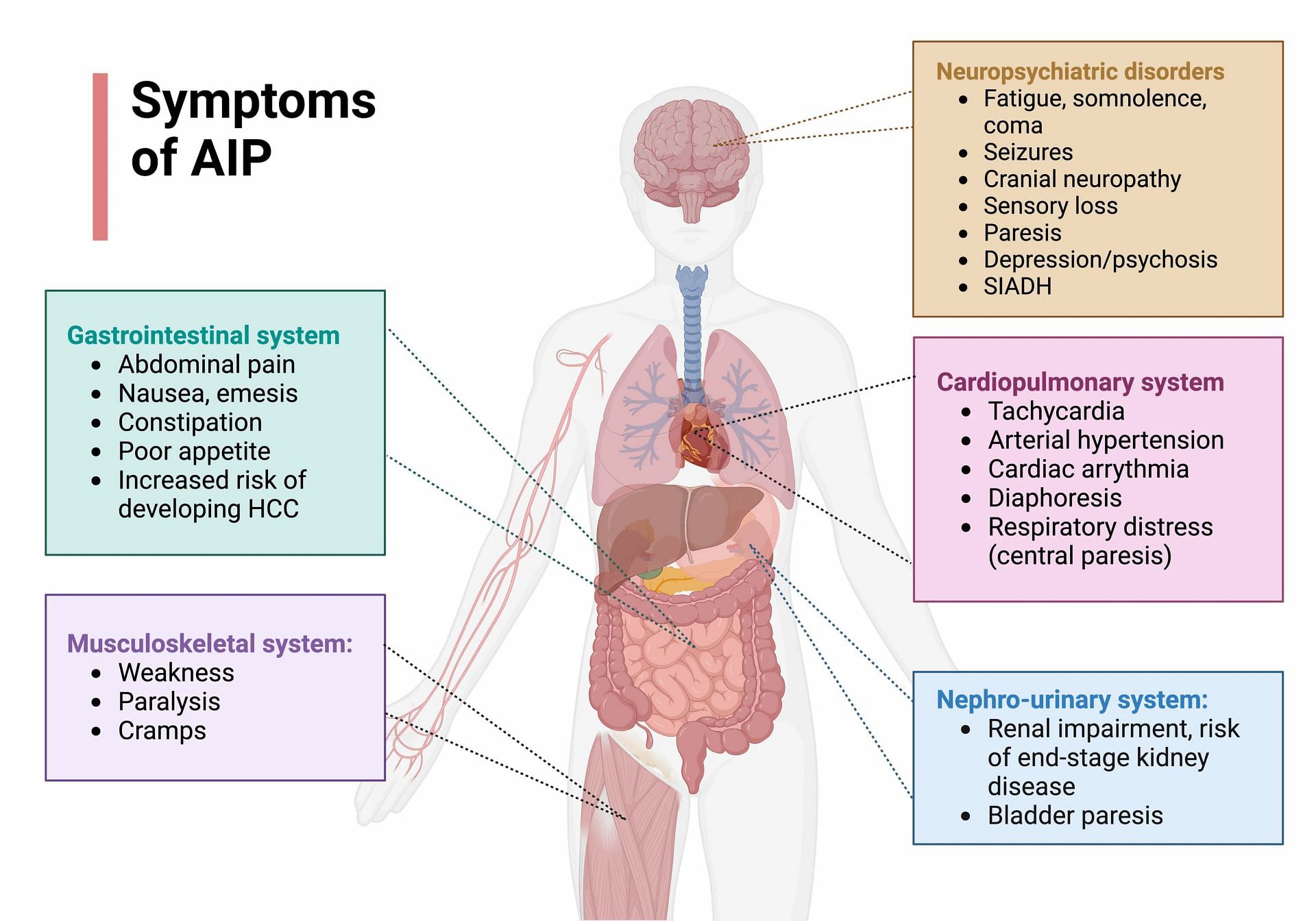 AIP is the most common and the one associated to psychiatric symptoms. (Image via Lightbox/ Lightbox)