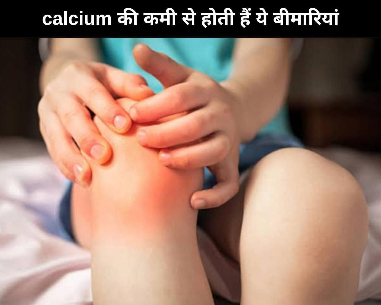 calcium की कमी से होती हैं ये 7 बीमारियां (फोटो - sportskeedaहिन्दी)