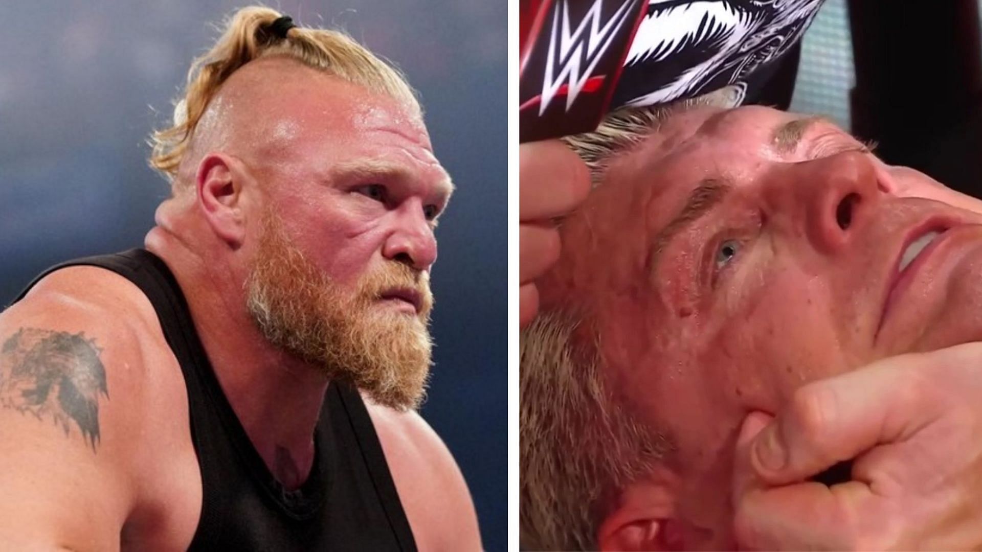 Brock Lesnar injury How many stitches did Brock Lesnar get on his forehead? Aftermath of brutal