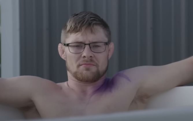 Breaking: Bryce Mitchell out of UFC 288 after being spotted with strange skin blemishes on Embedded episode