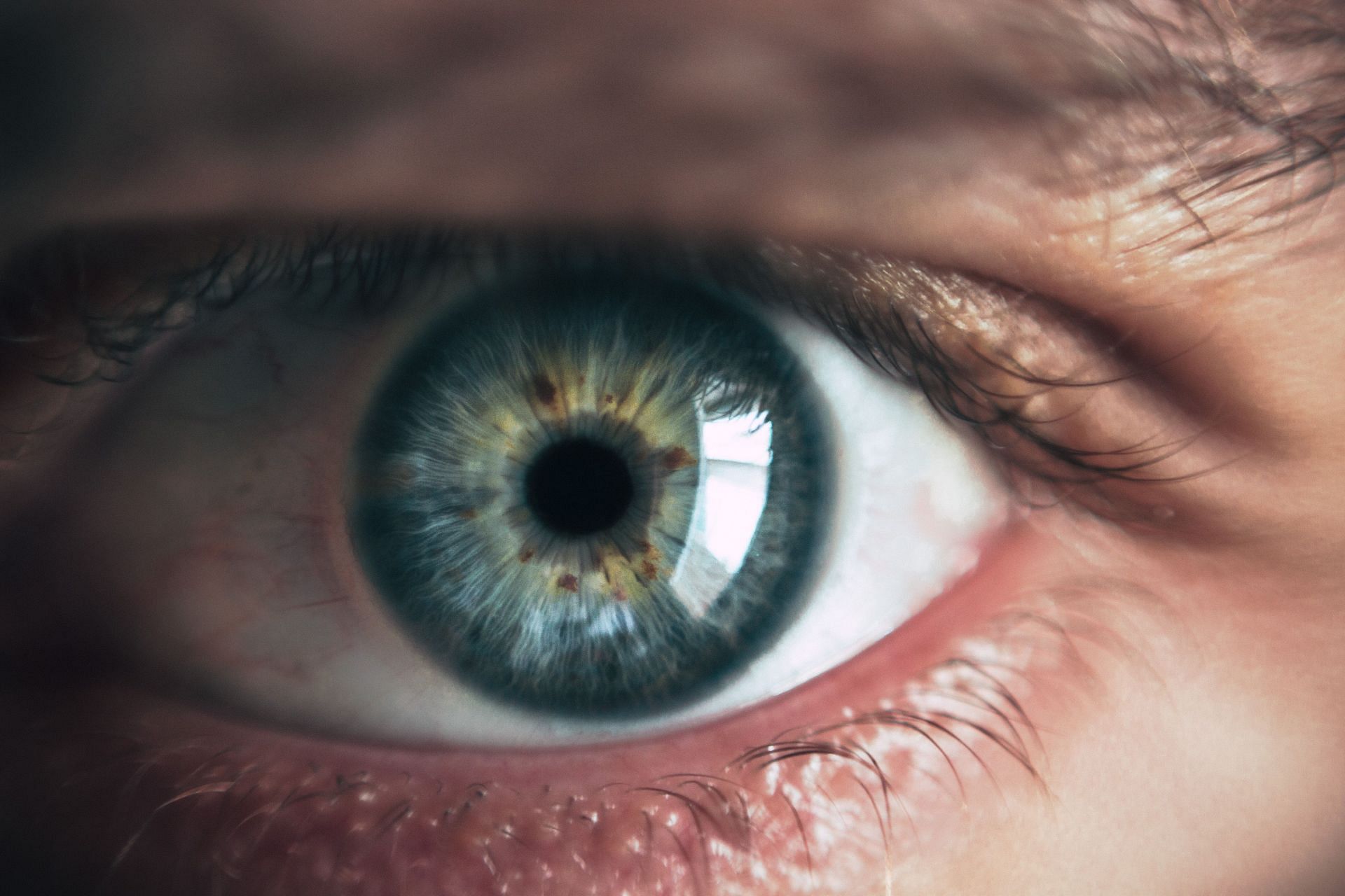 Eyes also indicate signs of high cholesterol. (Image via Pexels/ Victor Freitas)