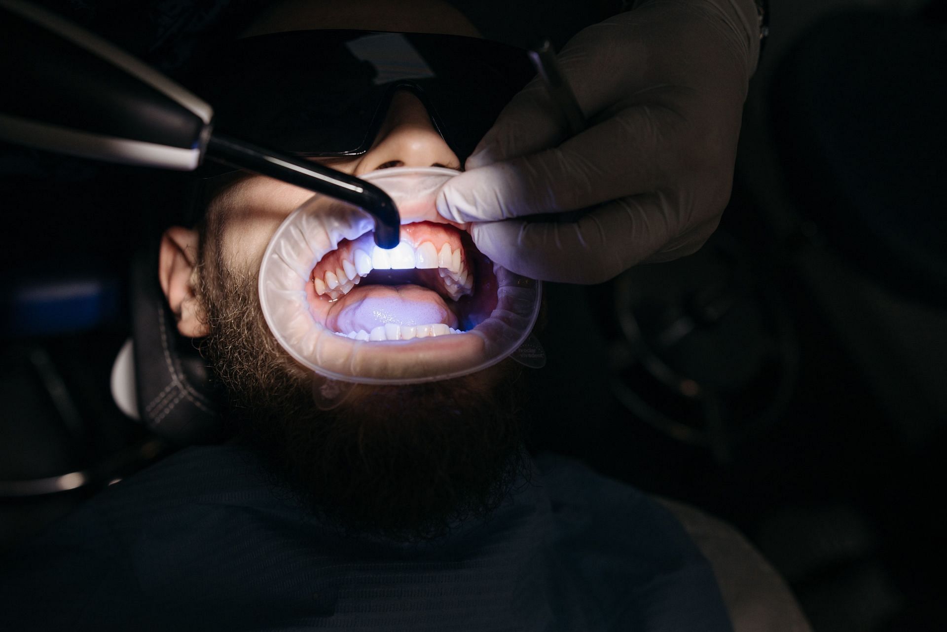 Unleashing the Power of Phosphorus for Optimal Oral Health (Image via Pexels)