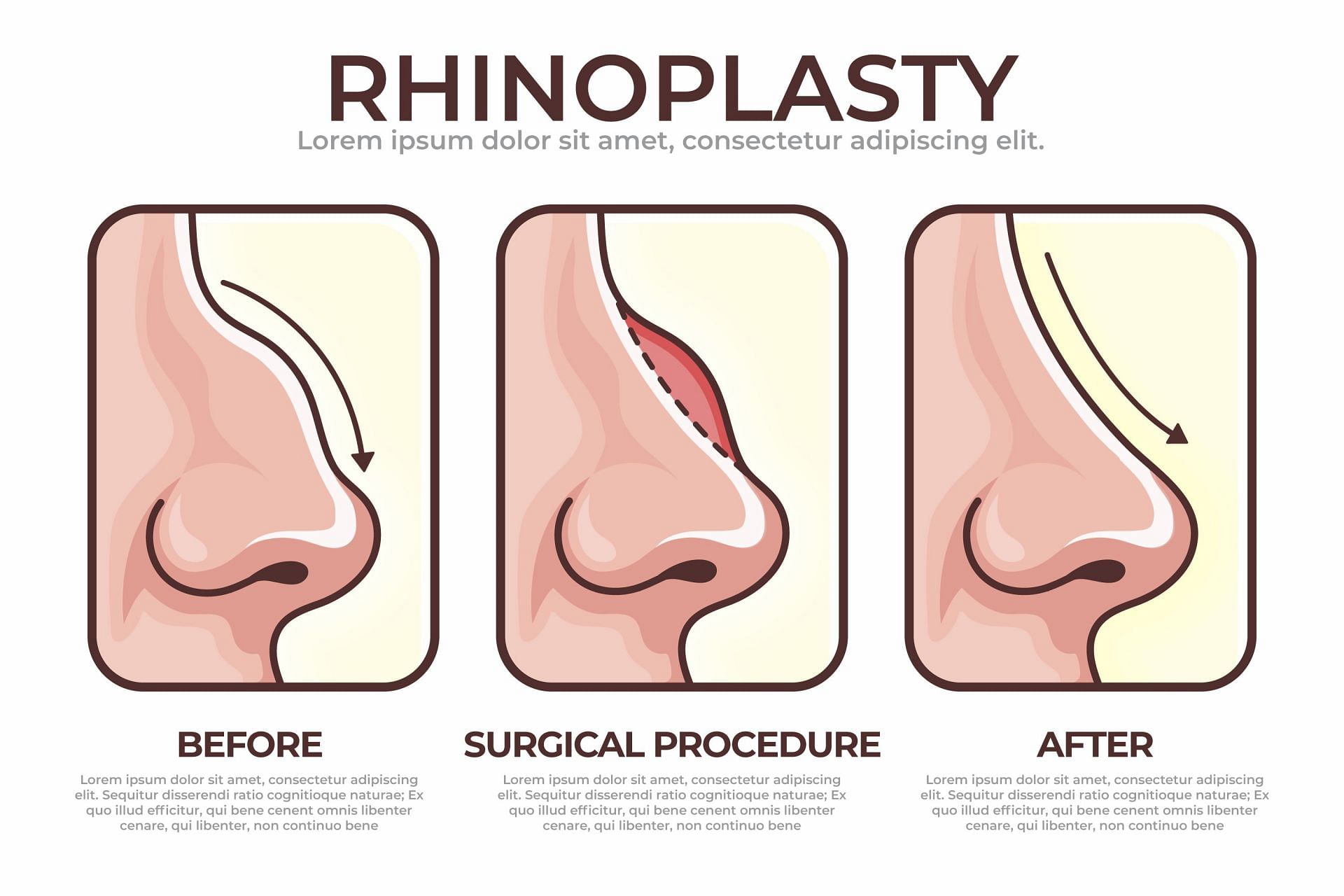 Surgery is one of the options in extreme cases. (Image via Freepik)