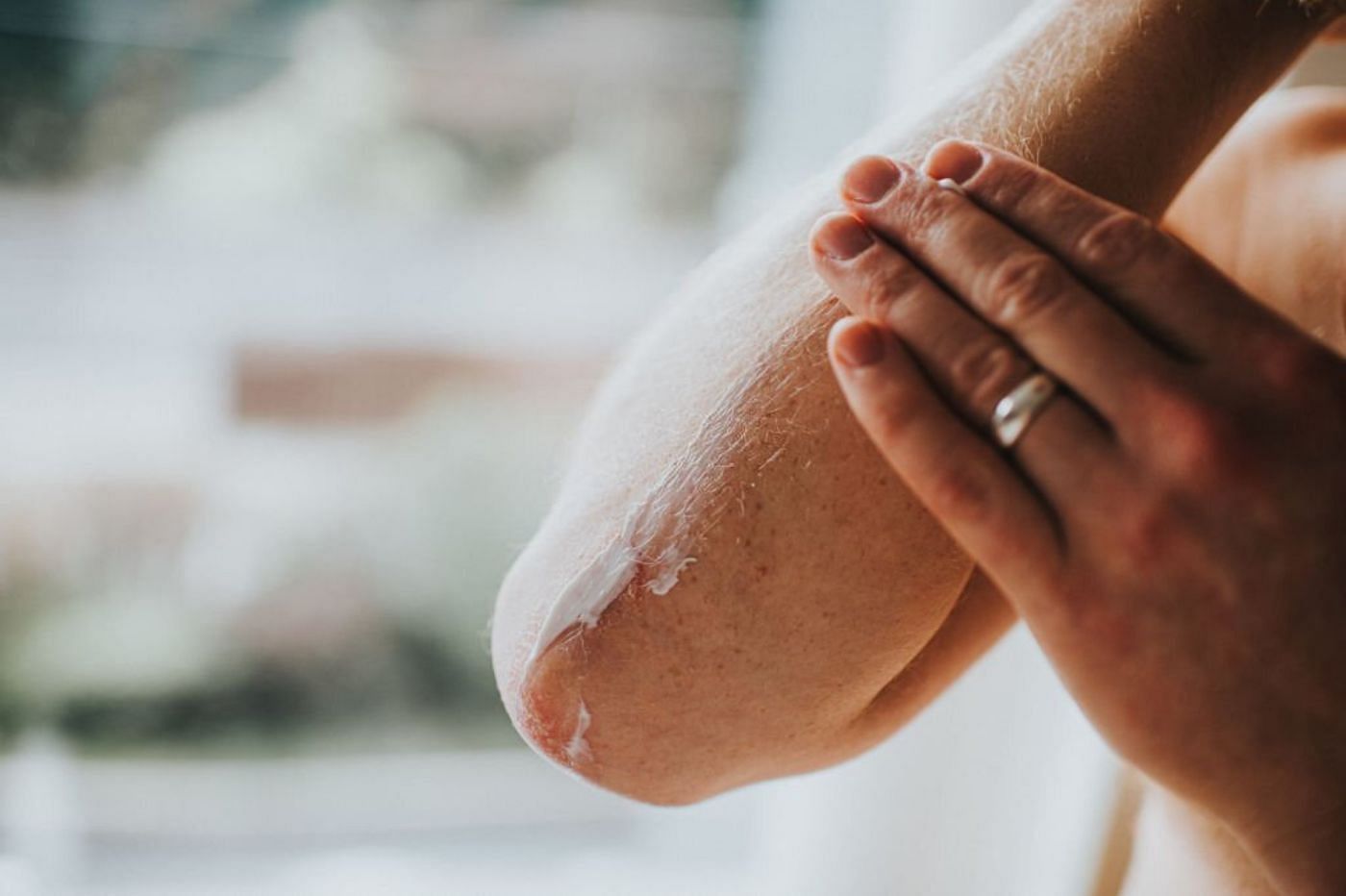 Common causes of dry skin and how to prevent them (Image via Pexels)