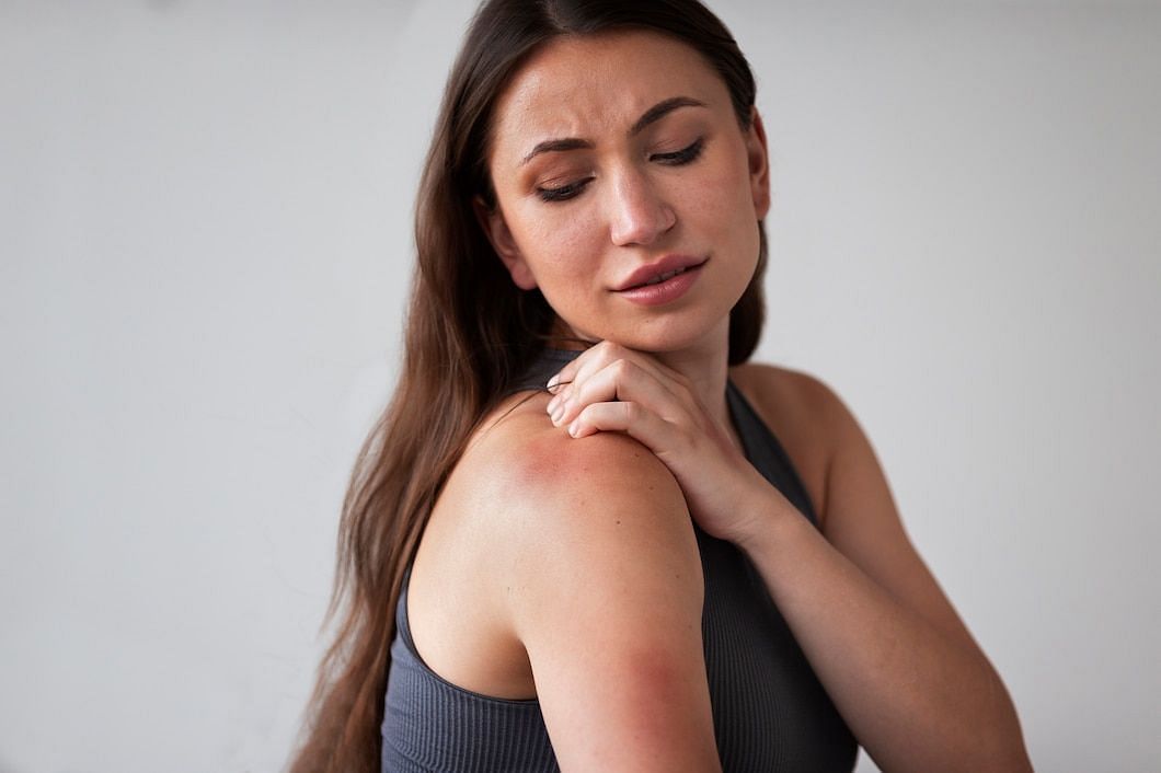 how to deal with common skin rashes (Image via freepik)