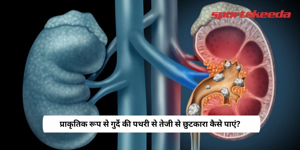 How to get rid of kidney stones fast naturally?