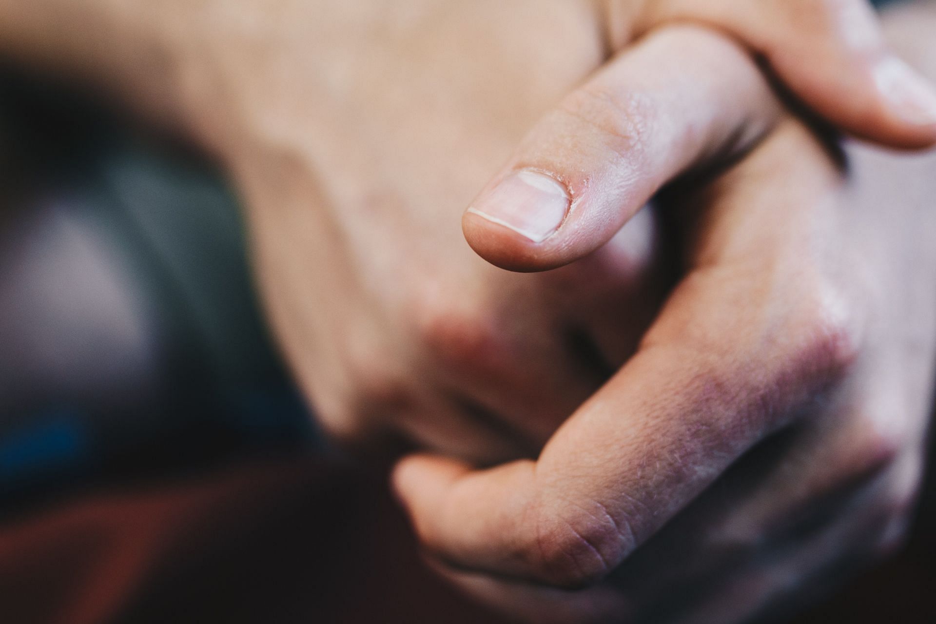 Vitamin A for Nails: Nourishing Your Nail Health Naturally (Image via Pexels)