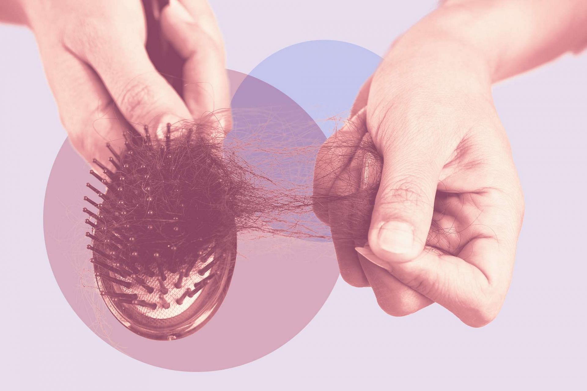 Poor Nutrition causes Hair loss (Image source/ Getty Images)
