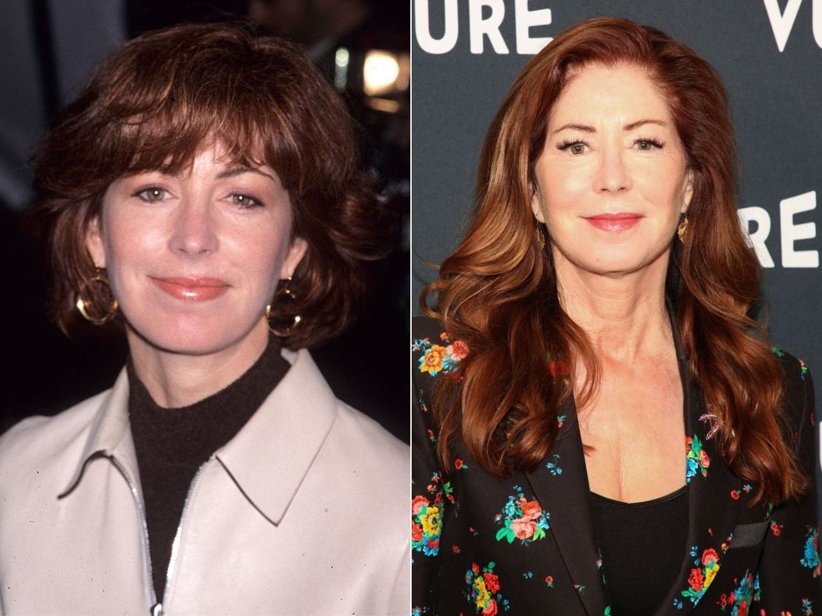 20 Female Celebs who were Unhappy with their Plastic Surgeries