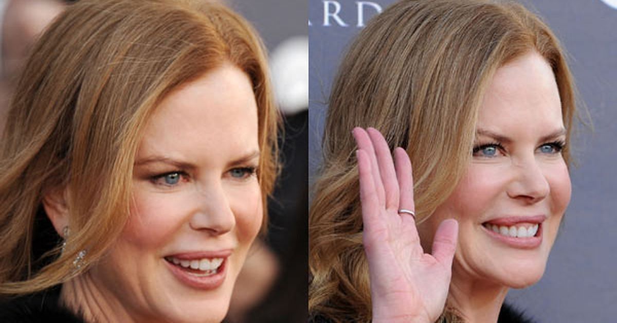 Nicole Kidman (Image via Getty)