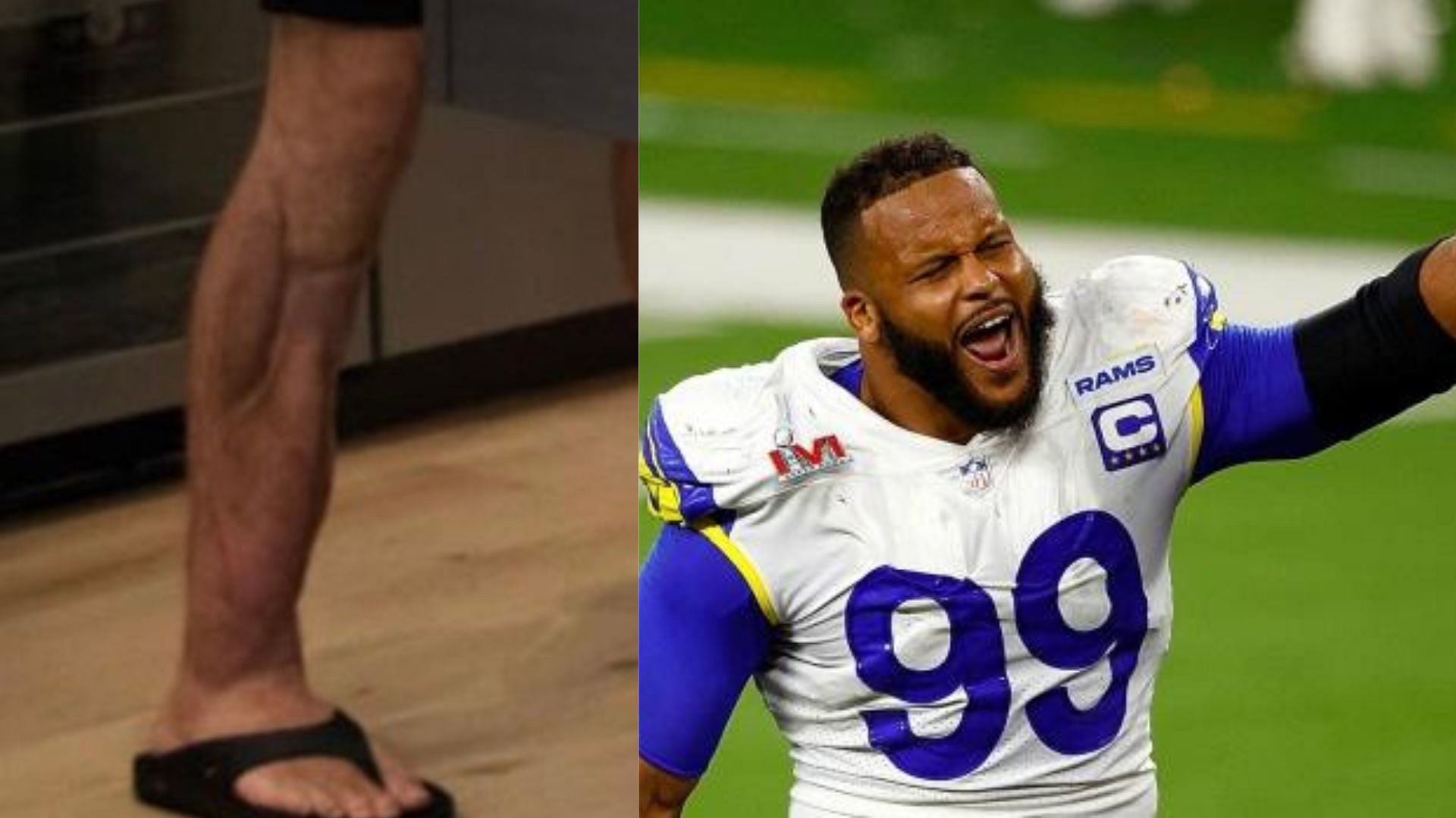 Fans comment on the leg of Alex Smith (L) and Rams DT Aaron Donald (R)
