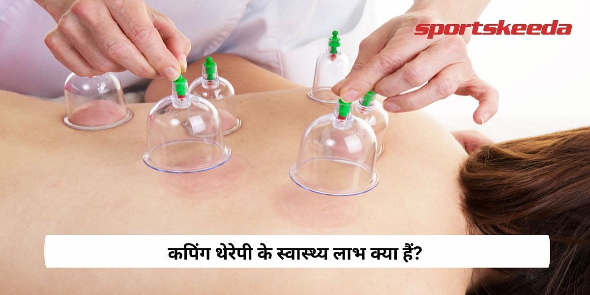What are the health benefits of cupping therapy?
